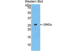 Western blot analysis of the recombinant protein. (LAP antibody  (AA 320-519))