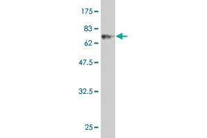 Western Blot detection against Immunogen (73. (CLN3 antibody  (AA 1-438))