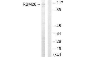 Western blot analysis of extracts from Jurkat cells, using RBM26 antibody. (RBM26 antibody  (C-Term))