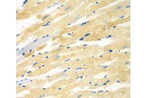 Immunohistochemistry of paraffin-embedded Rat heart using PDE4DIP Polyclonal Antibody at dilution of 1:100 (40x lens). (PDE4DIP antibody)