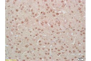 Immunohistochemistry (Paraffin-embedded Sections) (IHC (p)) image for anti-Myocyte Enhancer Factor 2A (MEF2A) (pSer408) antibody (ABIN743783)