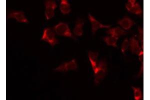 ABIN6266937 staining Hela by IF/ICC. (COX4I2 antibody  (Internal Region))
