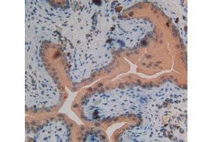 Used in DAB staining on fromalin fixed paraffin- embedded spermaduct tissue (PKC delta antibody  (AA 328-674))