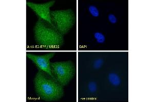 ABIN184893 Immunofluorescence analysis of paraformaldehyde fixed U2OS cells, permeabilized with 0.