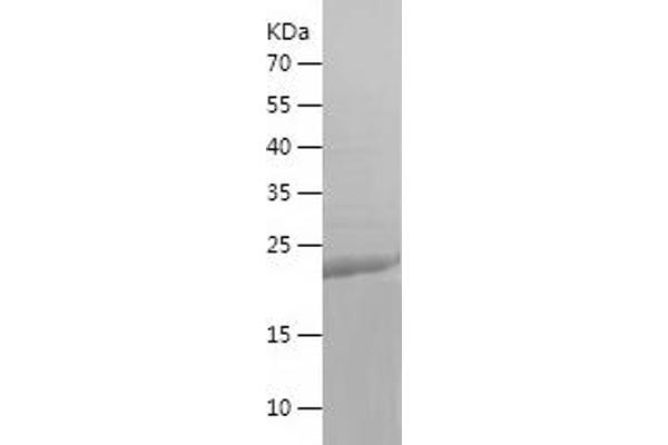 Ube2t Protein (AA 1-197) (His tag)