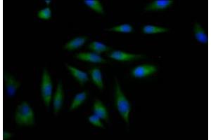 Immunofluorescence staining of Hela Cells with ABIN7127323 at 1:50, counter-stained with DAPI. (Recombinant ADAM17 antibody)