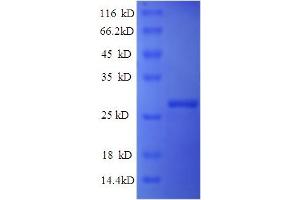 SDS-PAGE (SDS) image for Interferon, alpha-Inducible Protein 6 (IFI6) (AA 24-130) protein (His tag) (ABIN5713526)