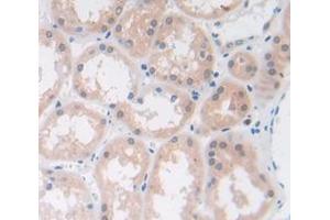 Figure. (ADK antibody  (AA 94-339))