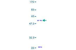 CELA2A Protein (AA 1-269) (GST tag)