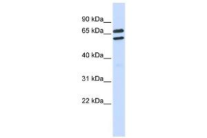 WB Suggested Anti-TRIML1 Antibody Titration:  0. (TRIML1 antibody  (Middle Region))