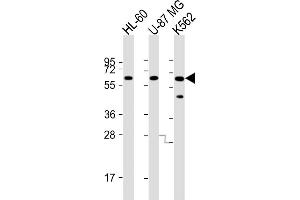 All lanes : Anti-IL1RL2 Antibody (Center) at 1:8000 dilution Lane 1: HL-60 whole cell lysate Lane 2: U-87 MG whole cell lysate Lane 3: K562 whole cell lysate Lysates/proteins at 20 μg per lane. (IL1RL2 antibody  (AA 257-286))