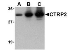 Image no. 1 for anti-C1q and Tumor Necrosis Factor Related Protein 2 (C1QTNF2) antibody (ABIN207843) (C1QTNF2 antibody)