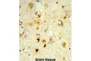 Immunohistochemistry (IHC) image for anti-Integrin, beta-Like 1 (With EGF-Like Repeat Domains) (ITGBL1) antibody (ABIN3003908) (ITGBL1 antibody)