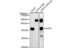 Immunoprecipitation (IP) image for anti-LIM and SH3 Protein 1 (LASP1) (AA 130-205) antibody (ABIN1680664)