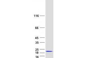 Validation with Western Blot (SUMO3 Protein (Myc-DYKDDDDK Tag))