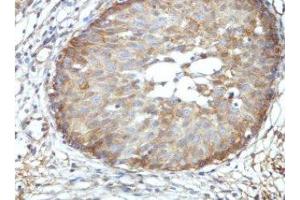 Immunohistochemical staining of formalin-fixed paraffin-embedded fetal urinary bladder showing nuclear staining with BRD9 Antibody at a dilution of 1/100.