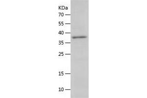 Western Blotting (WB) image for AKT1 Substrate 1 (Proline-Rich) (AKT1S1) (AA 1-256) protein (His tag) (ABIN7121759) (PRAS40 Protein (AA 1-256) (His tag))