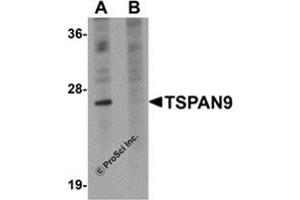 Western blot analysis of TSPAN9 in EL4 cell lysate with this product at 1 μg/ml in (A) the absence and (B) the presence of blocking peptide. (Tetraspanin 9 antibody  (Center))