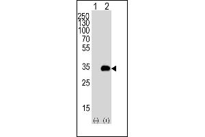 Western blot analysis of G5 (arrow) using rabbit polyclonal G5 Antibody 1812c. (ATG5 antibody)