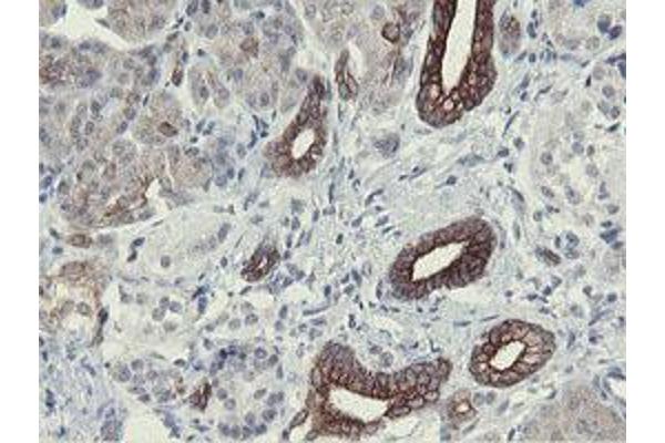 SLAP2 antibody