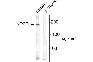 Western blots of rat hippocampal lysate showing specific immunolabeling of the ~180k NR2B subunit of the NMDAR phosphorylated at Tyr1336 (Control). (GRIN2B antibody  (pTyr1336))