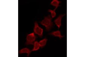 Immunofluorescence (fixed cells) (IF/ICC) image for anti-Caspase 9, Apoptosis-Related Cysteine Peptidase (CASP9) (pThr125) antibody (ABIN6256471)