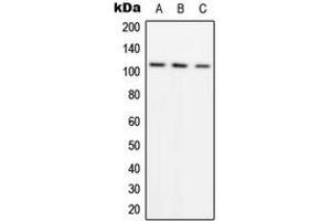 Western blot analysis of ADAMTS1 expression in A549 (A), SW480 (B), HeLa (C) whole cell lysates.
