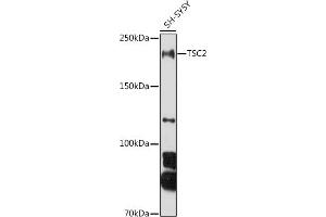 Western blot analysis of extracts of SH-SY5Y cells, using TSC2 antibody (ABIN6128542, ABIN6149611, ABIN6149612 and ABIN6213862) at 1:1000 dilution. (Tuberin antibody  (AA 900-1150))