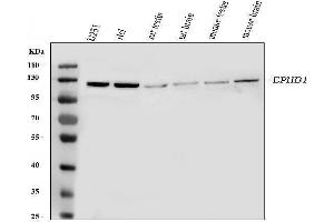 Western blot analysis of Eph receptor B1 using anti-Eph receptor B1 antibody (ABIN3042375). (EPH Receptor B1 antibody  (N-Term))