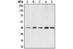 Western blot analysis of ERCC1 expression in MCF7 (A), HeLa (B), A431 (C), mouse liver (D), rat kidney (E) whole cell lysates. (ERCC1 antibody  (Center))