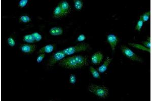 IF analysis of FEZF1 using anti-FEZF1 antibody (ABIN7601763). (FEZF1 antibody  (AA 45-258))