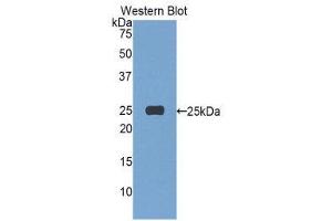 Western Blotting (WB) image for anti-Afamin (AFM) (AA 22-210) antibody (ABIN3205290) (Afamin antibody  (AA 22-210))