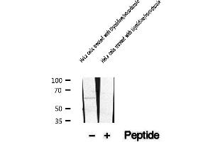 Western blot analysis of extracts of HeLa cells treated with thymidine/nocodazole , using Phospho-PLK1 (Thr210) Antibody.