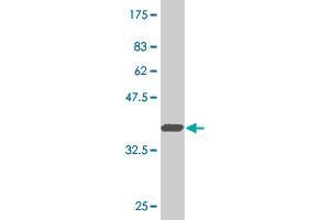 Western Blot detection against Immunogen (36. (BARHL1 antibody  (AA 55-154))