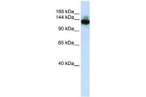WB Suggested Anti-SCAND3 Antibody Titration:  0. (SCAND3 antibody  (C-Term))