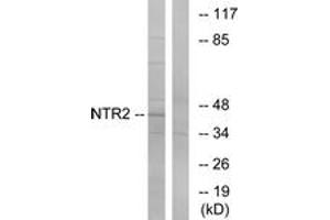 Western blot analysis of extracts from Jurkat cells, using NTR2 Antibody. (NTSR2 antibody  (AA 151-200))