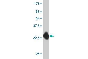 Western Blot detection against Immunogen (35. (DYX1C1 antibody  (AA 336-420))