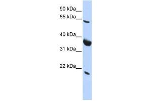 WB Suggested Anti-SRPR Antibody Titration:  0. (SRPR antibody  (Middle Region))