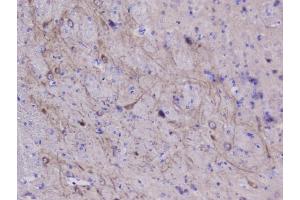 IHC analysis of NSE using anti-NSE antibody (ABIN6719549). (ENO2/NSE antibody)