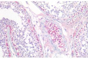 (ABIN571207) (5 μg/mL) staining of paraffin embedded Human Testis. (UCHL1 antibody  (AA 211-221))