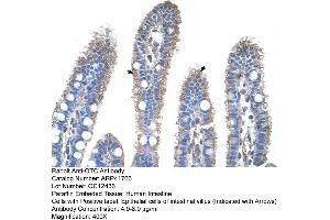 Rabbit Anti-OTC Antibody  Paraffin Embedded Tissue: Human Intestine Cellular Data: Epithelial cells of intestinal villas Antibody Concentration: 4. (OTC antibody  (N-Term))