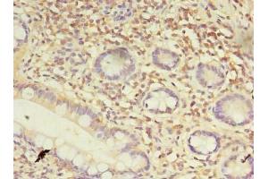 Immunohistochemistry of paraffin-embedded human small intestine tissue using ABIN7164351 at dilution of 1:100 (DDX31 antibody  (AA 560-851))