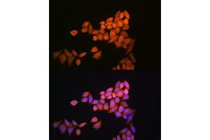 Immunofluorescence analysis of NIH-3T3 cells using Thioredoxin 1 (Trx1/Thioredoxin 1 (Trx1/TXN)) Rabbit pAb (ABIN6133954, ABIN6149719, ABIN6149721 and ABIN6213598) at dilution of 1:100 (40x lens). (TXN antibody  (AA 1-100))