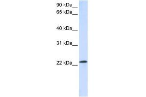 RAB18 antibody used at 1 ug/ml to detect target protein. (RAB18 antibody  (C-Term))