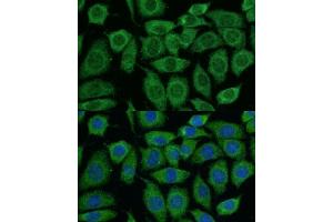 Immunofluorescence analysis of L929 cells using DLAT antibody (ABIN7266768) at dilution of 1:100. (DLAT antibody  (AA 87-270))