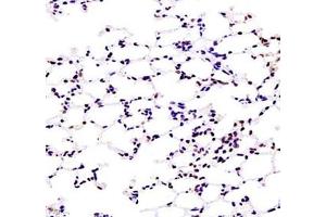 Immunohistochemistry of paraffin embedded mouse lung using ZKSCAN4 (ABIN7076265) at dilution of 1:1300 (400x lens)