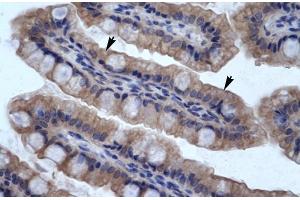Human Intestine; SMPDL3B antibody - N-terminal region in Human Intestine cells using Immunohistochemistry (SMPDL3B antibody  (N-Term))