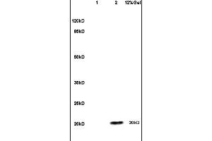 Lane 1: mouse brain lysates Lane 2: human colon carcinoma lysates probed with Anti ESM1 Polyclonal Antibody, Unconjugated (ABIN701635) at 1:200 in 4 °C. (ESM1 antibody  (AA 51-150))