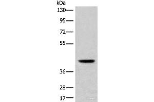 Western blot analysis of Mouse liver tissue lysate using USP12 Polyclonal Antibody at dilution of 1:700 (USP12 antibody)