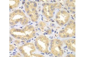 Immunohistochemistry of paraffin-embedded Human kidney using ELMO3 Polyclonal Antibody at dilution of 1:100 (40x lens). (ELMO3 antibody)